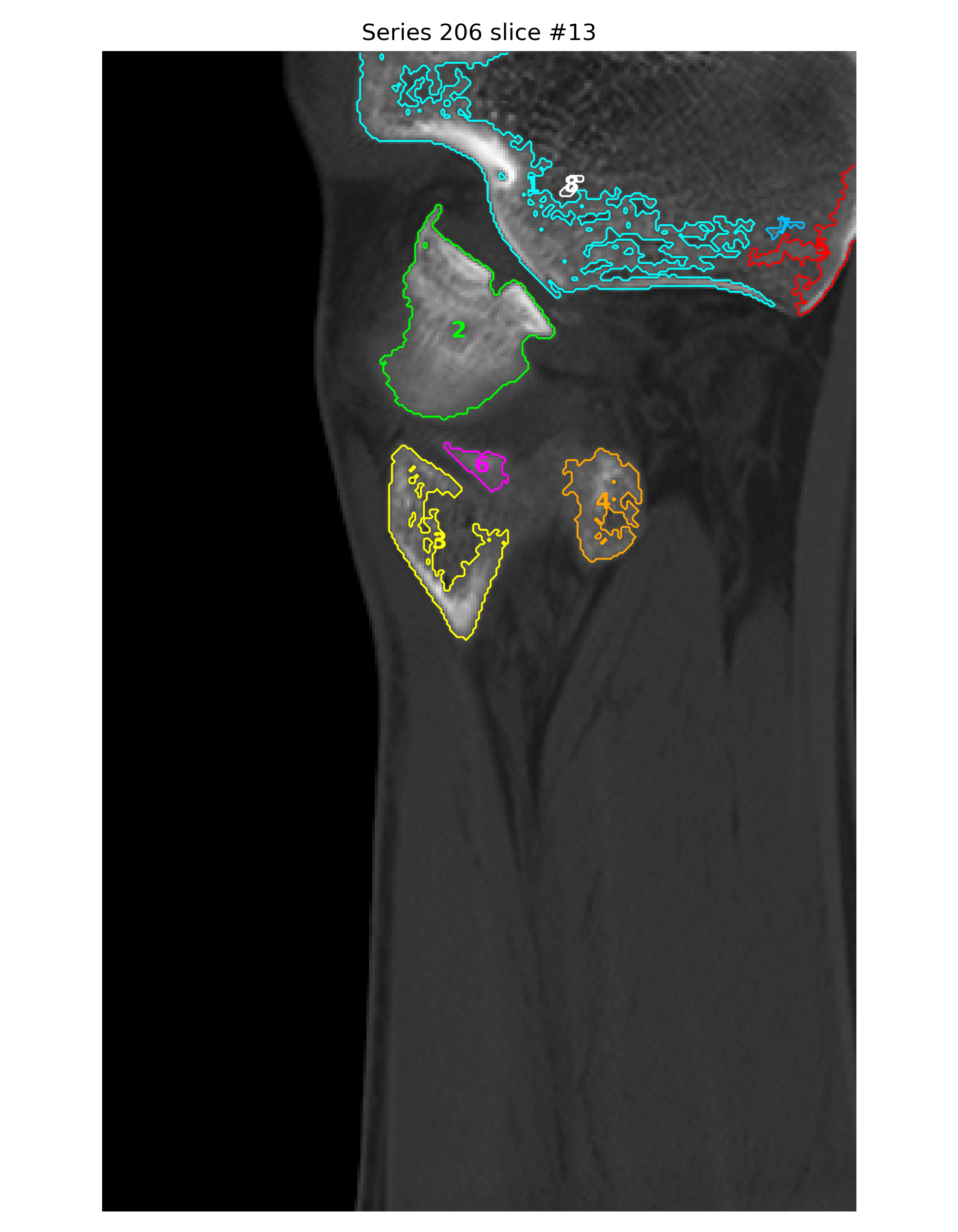 Sagittal component labels
