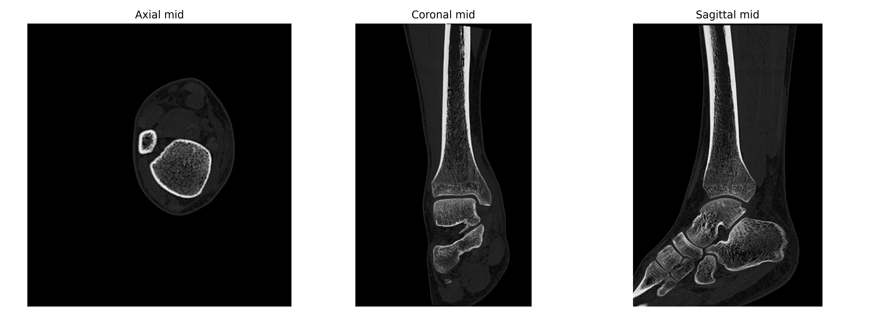 Orthogonal mid slices
