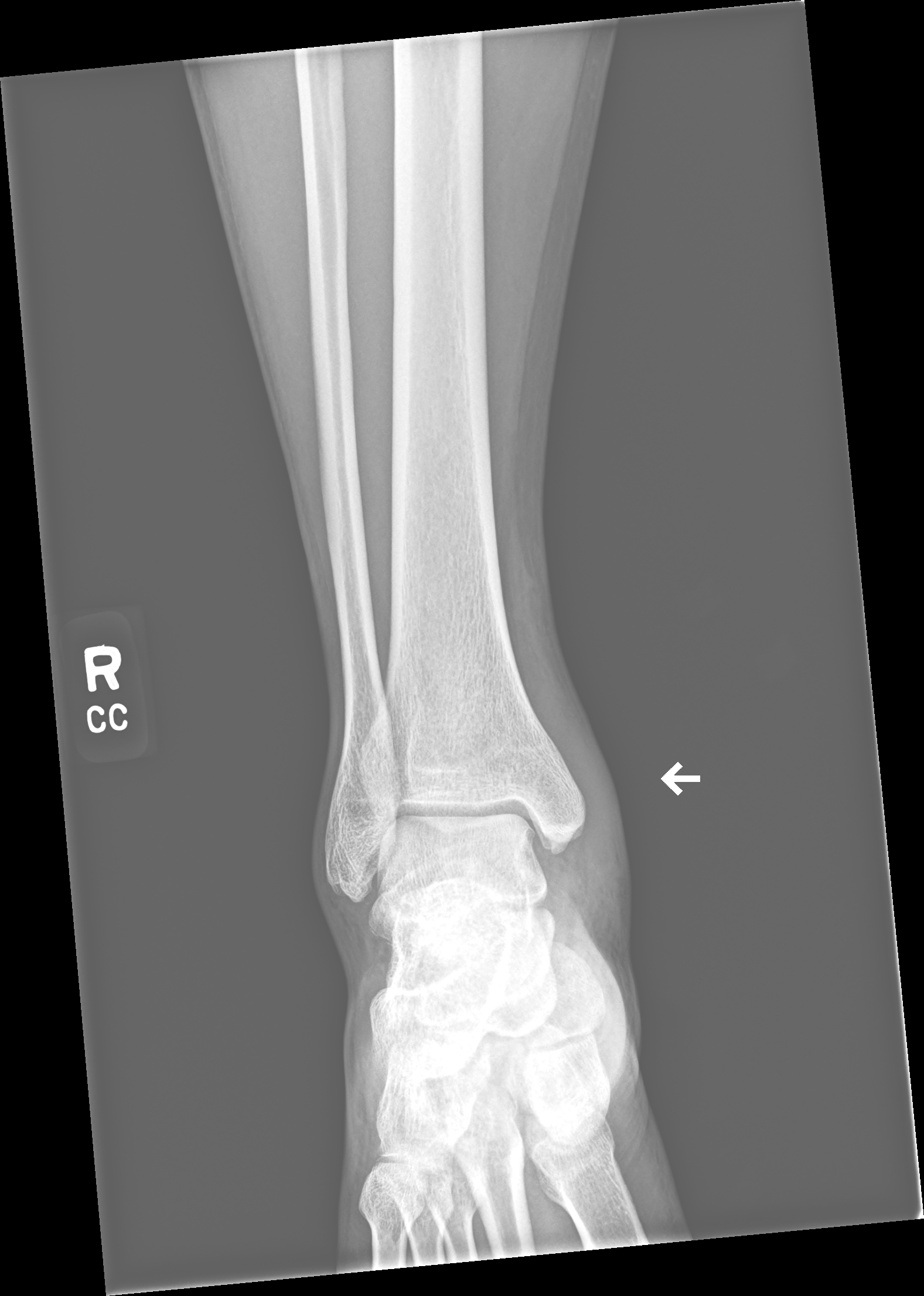 X-ray view 1