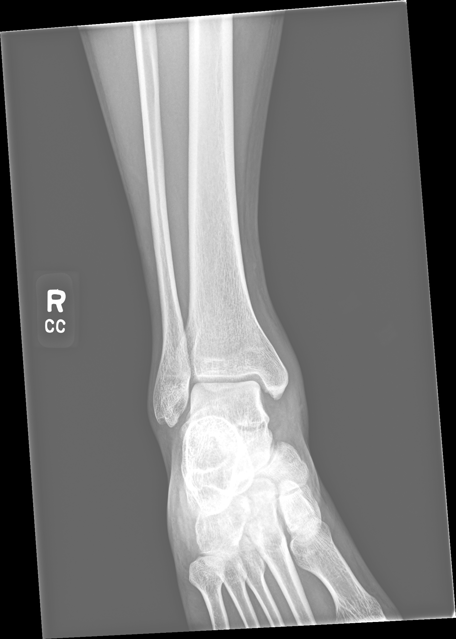 X-ray view 2